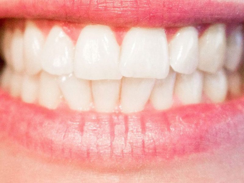 estetica-dental-mataelpino